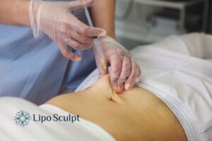 Does Skin Sag After Fat Dissolving Injections? 2 Do you want to get Aqualyx fat dissolving injections Selston but worried about loose skin afterwards?