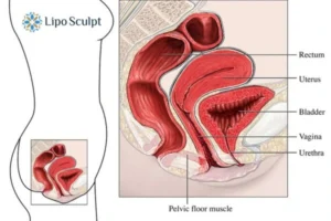 Treatment For A Leaky Bladder 2 How EM Chair treatment Selston can help Leaky bladder issues. Read more now!