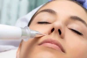 Best Actinic Keratoses Removal 3 Actinic keratoses Selston solutions - book in today!